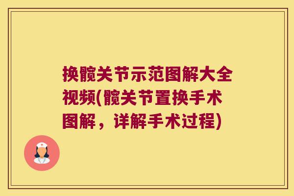 换髋关节示范图解大全视频(髋关节置换手术图解,详解手术过程)