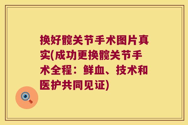 换好髋关节手术图片真实(成功更换髋关节手术全程:鲜血、技术和医护共同见证)