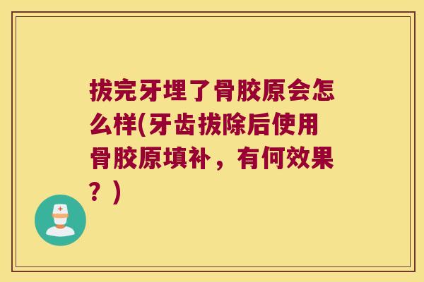 拔完牙埋了骨胶原会怎么样(牙齿拔除后使用骨胶原填补,有何效果?)