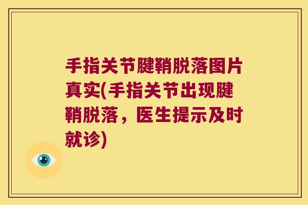 手指关节腱鞘脱落图片真实(手指关节出现腱鞘脱落,医生提示及时就诊) 手指关节腱鞘脱落图片真实(手指关节出现腱鞘脱落,医生提示及时就诊)