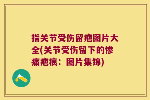 指关节受伤留疤图片大全(关节受伤留下的惨痛疤痕:图片集锦)