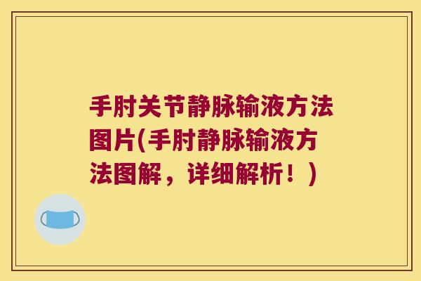 手肘关节静脉输液方法图片(手肘静脉输液方法图解,详细解析!)