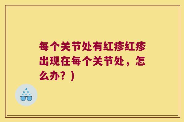 每个关节处有红疹红疹出现在每个关节处,怎么办?)