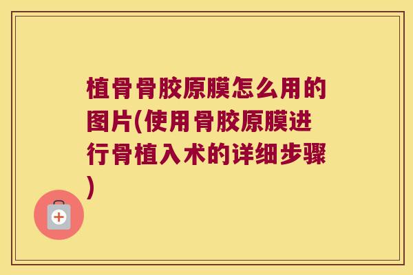 植骨骨胶原膜怎么用的图片(使用骨胶原膜进行骨植入术的详细步骤)