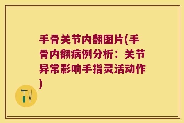 手骨关节内翻图片(手骨内翻病例分析:关节异常影响手指灵活动作)