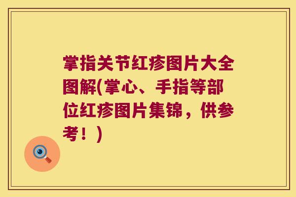 掌指关节红疹图片大全图解(掌心、手指等部位红疹图片集锦,供参考!)