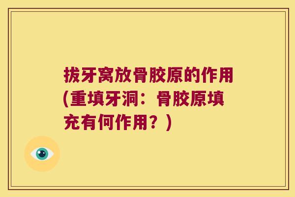 拔牙窝放骨胶原的作用(重填牙洞:骨胶原填充有何作用?)