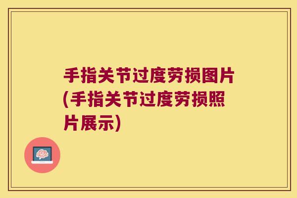 手指关节过度劳损图片(手指关节过度劳损照片展示)