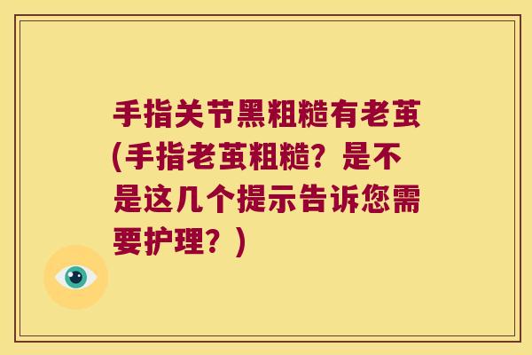 手指关节黑粗糙有老茧(手指老茧粗糙?是不是这几个提示告诉您需要护理?)
