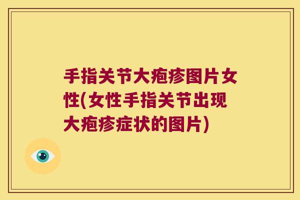 手指关节大疱疹图片女性(女性手指关节出现大疱疹症状的图片)