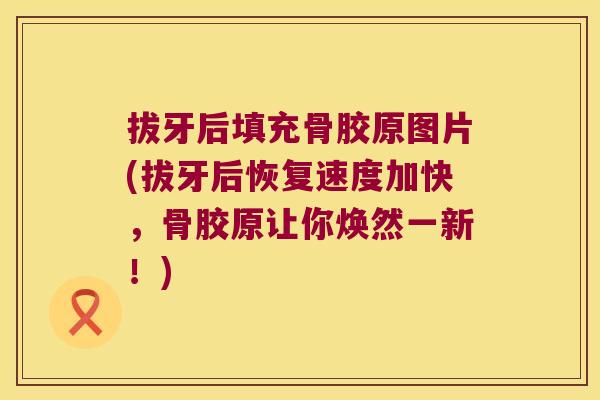 拔牙后填充骨胶原图片(拔牙后恢复速度加快,骨胶原让你焕然一新!)