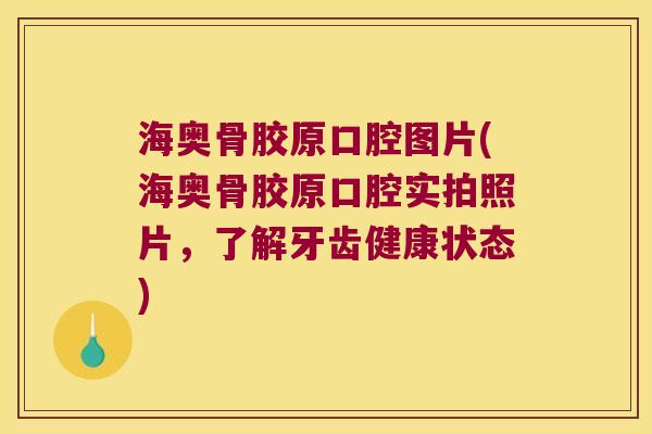 海奥骨胶原口腔图片(海奥骨胶原口腔实拍照片,了解牙齿健康状态)