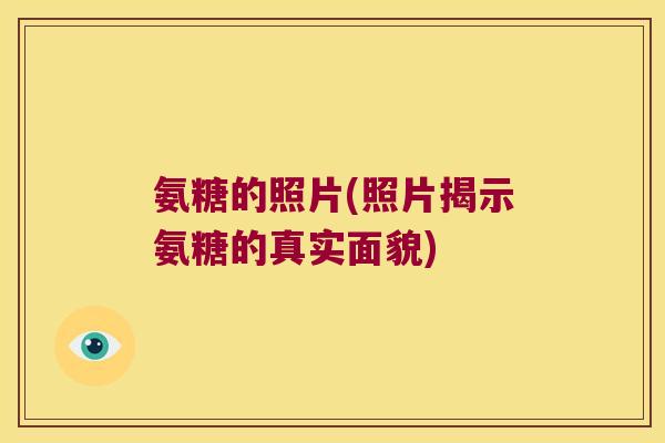 氨糖的照片(照片揭示氨糖的真实面貌)
