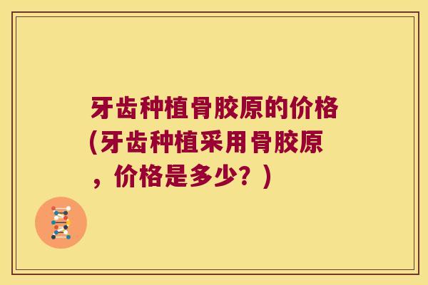 牙齿种植骨胶原的价格(牙齿种植采用骨胶原,价格是多少?)