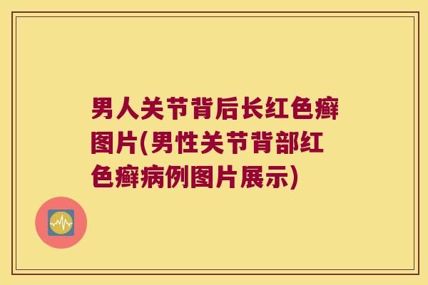 男人关节背后长红色癣图片(男性关节背部红色癣病例图片展示)