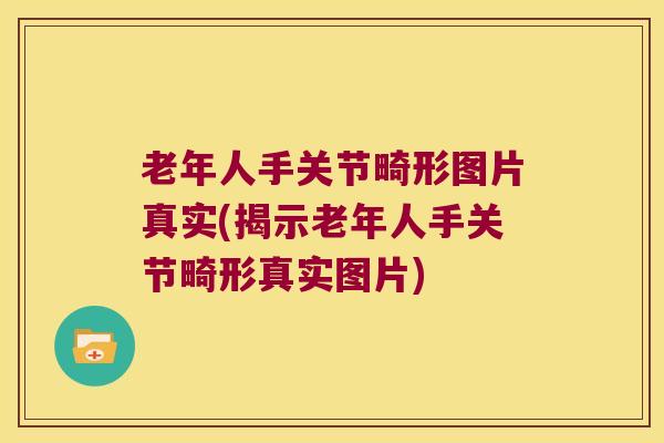 老年人手关节畸形图片真实(揭示老年人手关节畸形真实图片)