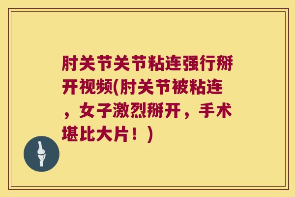 肘关节关节粘连强行掰开视频(肘关节被粘连,女子激烈掰开,手术堪比大片!) 肘关节关节粘连强行掰开视频(肘关节被粘连,女子激烈掰开,手术堪比大片!)