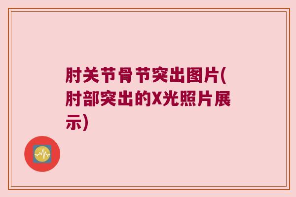 肘关节骨节突出图片(肘部突出的X光照片展示)