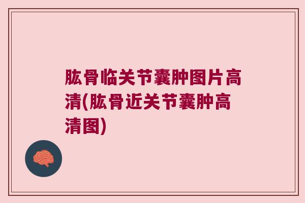 肱骨临关节囊肿图片高清(肱骨近关节囊肿高清图)