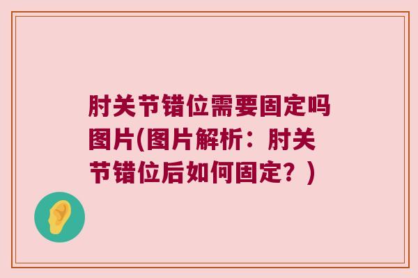 肘关节错位需要固定吗图片(图片解析:肘关节错位后如何固定?)