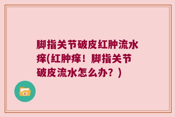 脚指关节破皮红肿流水痒(红肿痒!脚指关节破皮流水怎么办?)