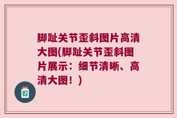 脚趾关节歪斜图片高清大图(脚趾关节歪斜图片展示:细节清晰、高清大图!)