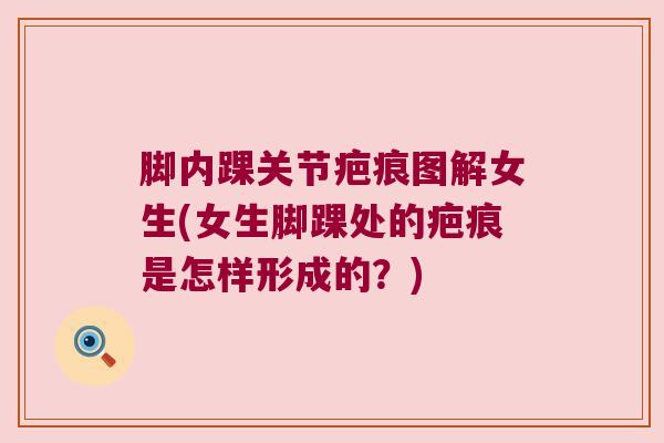 脚内踝关节疤痕图解女生(女生脚踝处的疤痕是怎样形成的?)