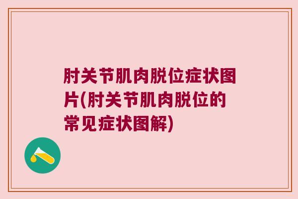肘关节肌肉脱位症状图片(肘关节肌肉脱位的常见症状图解)
