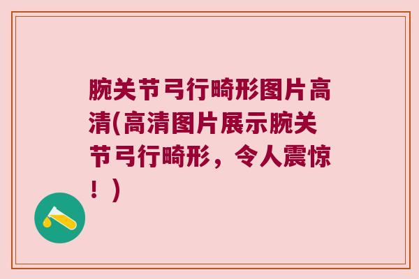 腕关节弓行畸形图片高清(高清图片展示腕关节弓行畸形，令人震惊！)