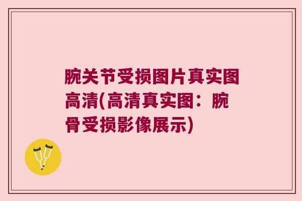腕关节受损图片真实图高清(高清真实图:腕骨受损影像展示)