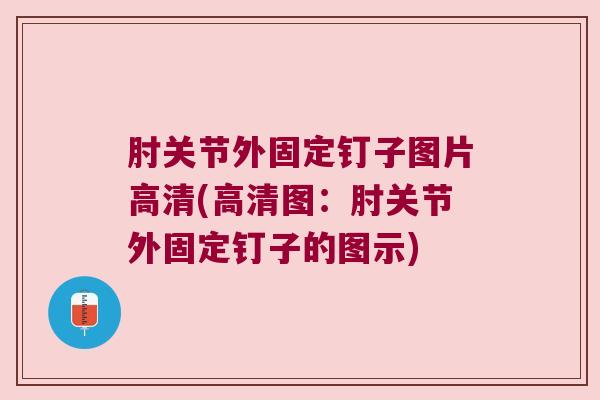 肘关节外固定钉子图片高清(高清图:肘关节外固定钉子的图示)