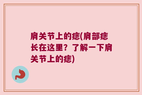 肩关节上的痣(肩部痣长在这里?了解一下肩关节上的痣)