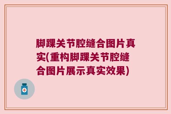 脚踝关节腔缝合图片真实(重构脚踝关节腔缝合图片展示真实效果)