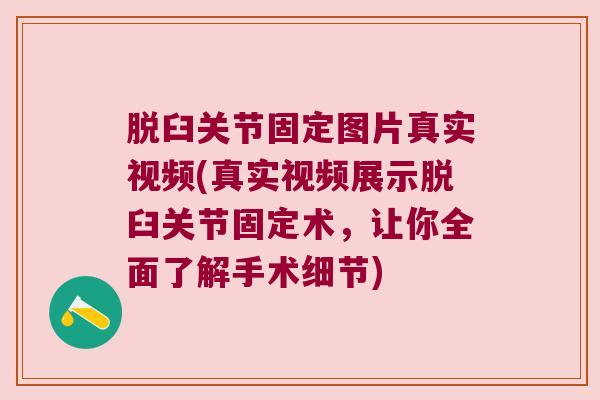 脱臼关节固定图片真实视频(真实视频展示脱臼关节固定术,让你全面了解手术细节) 脱臼关节固定图片真实视频(真实视频展示脱臼关节固定术,让你全面了解手术细节)