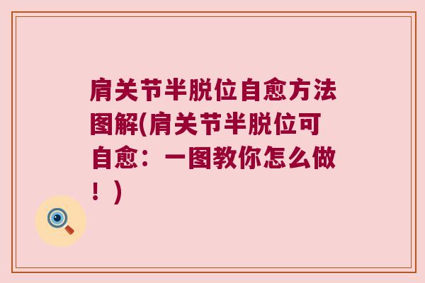 肩关节半脱位自愈方法图解(肩关节半脱位可自愈:一图教你怎么做!)