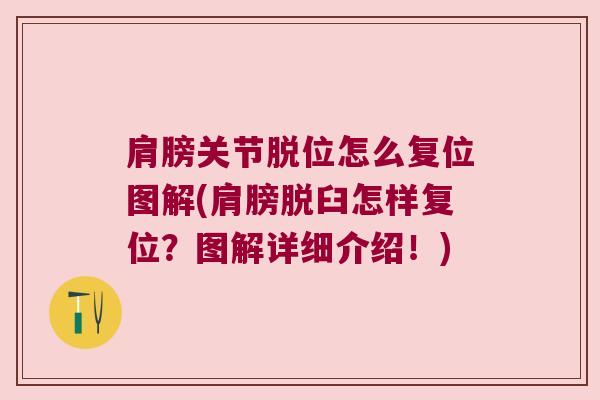 肩膀关节脱位怎么复位图解(肩膀脱臼怎样复位?图解详细介绍!)