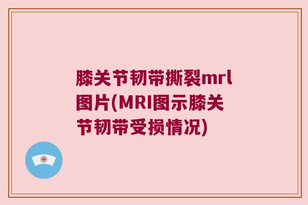 膝关节韧带撕裂mrl图片(MRI图示膝关节韧带受损情况)