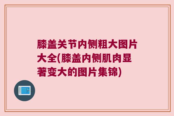 膝盖关节内侧粗大图片大全(膝盖内侧肌肉显著变大的图片集锦)