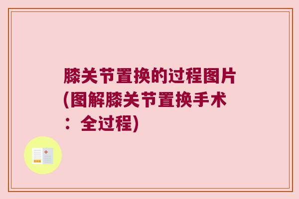 膝关节置换的过程图片(图解膝关节置换手术:全过程)