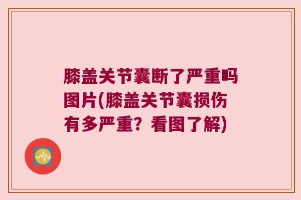 膝盖关节囊断了严重吗图片(膝盖关节囊损伤有多严重?看图了解) 膝盖关节囊断了严重吗图片(膝盖关节囊损伤有多严重?看图了解)