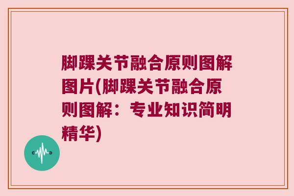 脚踝关节融合原则图解图片(脚踝关节融合原则图解:专业知识简明精华)
