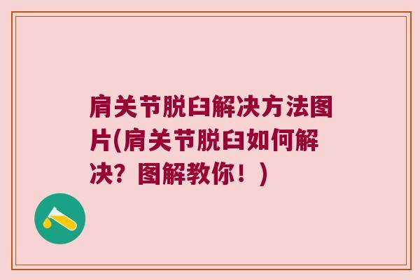肩关节脱臼解决方法图片(肩关节脱臼如何解决?图解教你!)