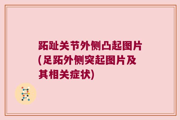 跖趾关节外侧凸起图片(足跖外侧突起图片及其相关症状)