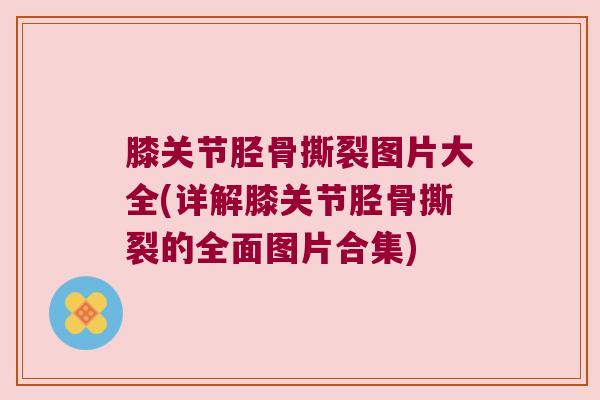 膝关节胫骨撕裂图片大全(详解膝关节胫骨撕裂的全面图片合集)