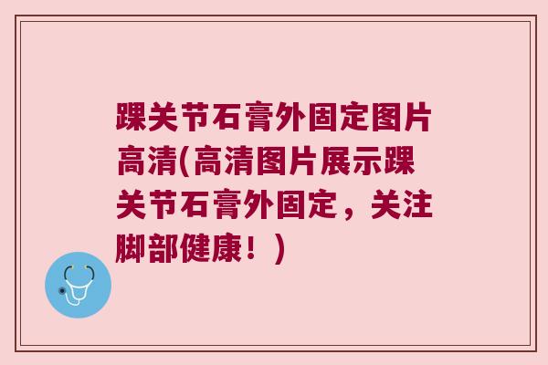 踝关节石膏外固定图片高清(高清图片展示踝关节石膏外固定,关注脚部健康!)