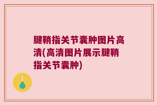 腱鞘指关节囊肿图片高清(高清图片展示腱鞘指关节囊肿) 腱鞘指关节囊肿图片高清(高清图片展示腱鞘指关节囊肿)