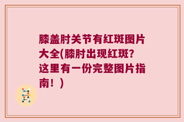 膝盖肘关节有红斑图片大全(膝肘出现红斑?这里有一份完整图片指南!)