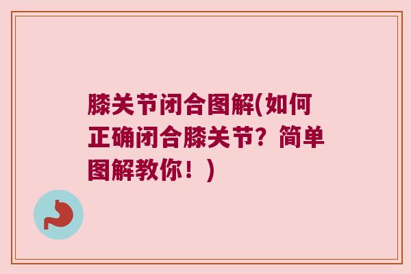 膝关节闭合图解(如何正确闭合膝关节?简单图解教你!)